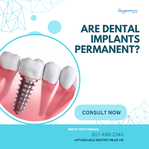 Featured image for Auto-prepared featured image