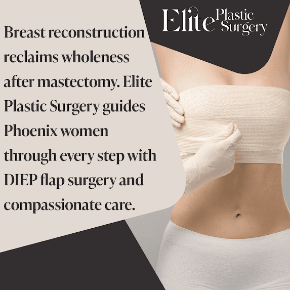 Featured image for Auto-prepared featured image