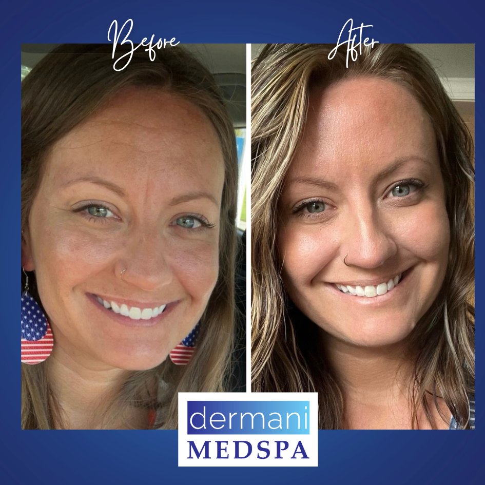 Granger, IN medspa Introduces $9 Per Unit Botox® Cosmetic