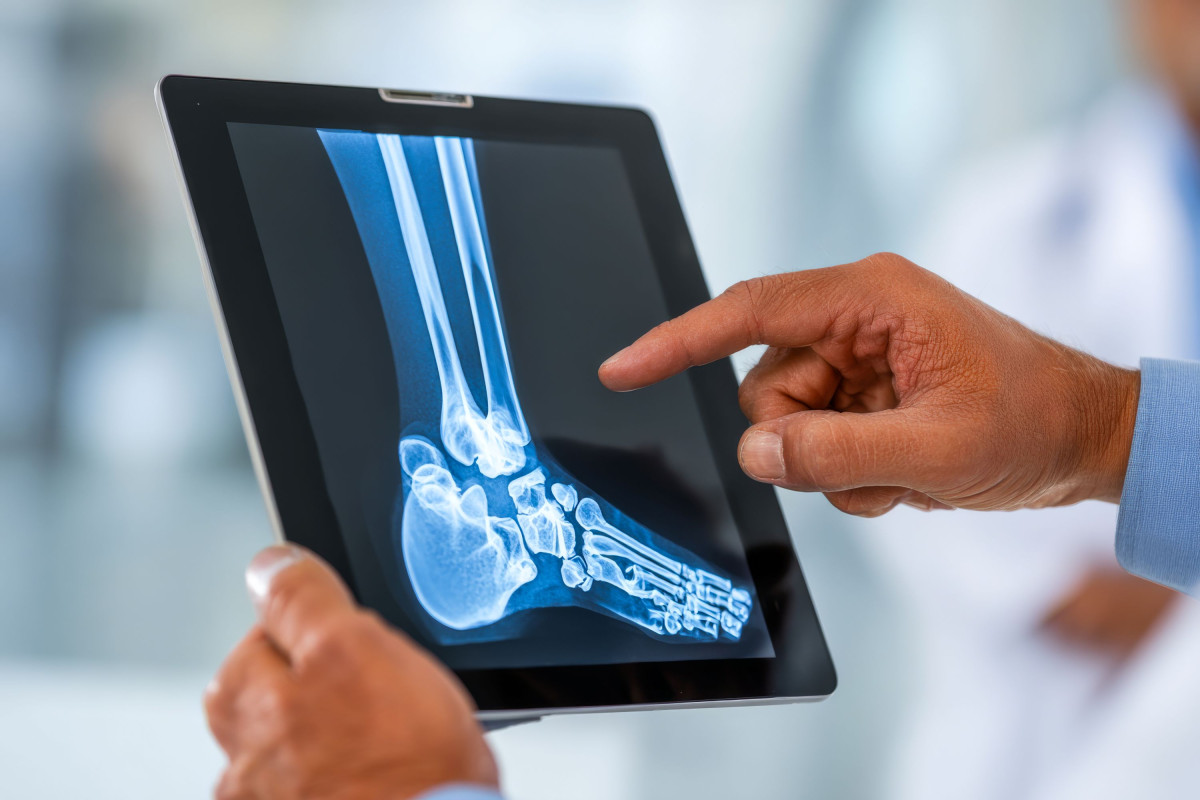Advanced Orthopedic Care at Atlanta Bone and Joint Specialists in Snellville