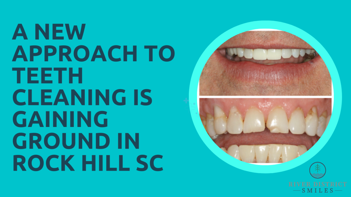 A New Approach to Teeth Cleaning is Gaining Ground in Rock Hill SC