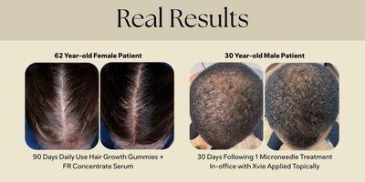 Featured image for Auto-prepared featured image